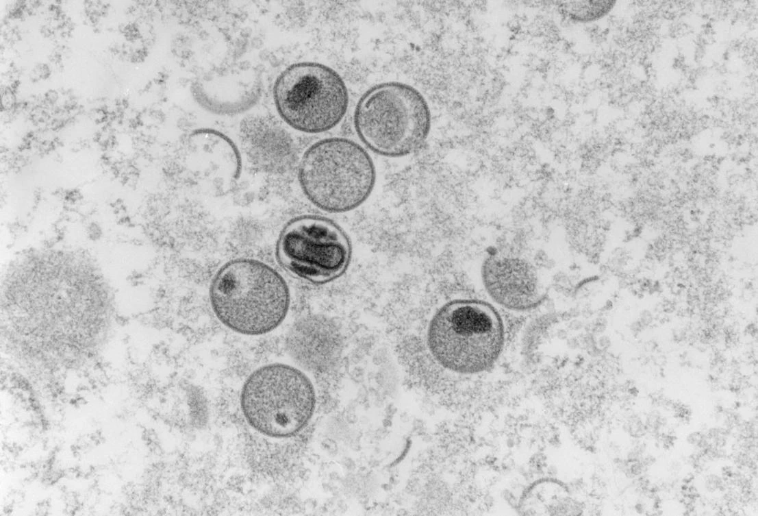 An outbreak of monkeypox could be devastating for Sudan, which suffered from decades of conflict in Darfur and other parts of the country, and international isolation. (File/AFP)