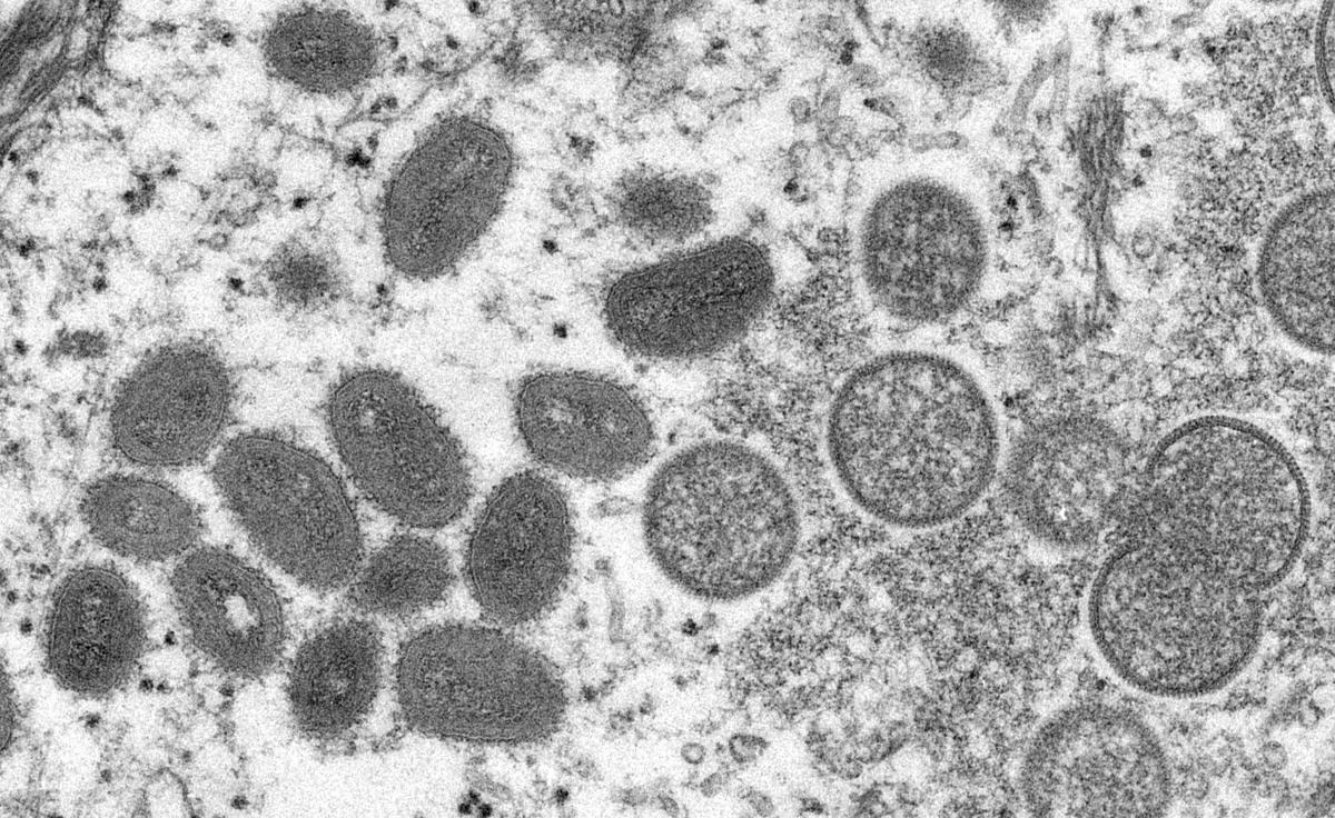 The UN health agency announced last week that a group of experts it had convened had already agreed on new names for monkeypox virus variants, or clades. (File/AFP)