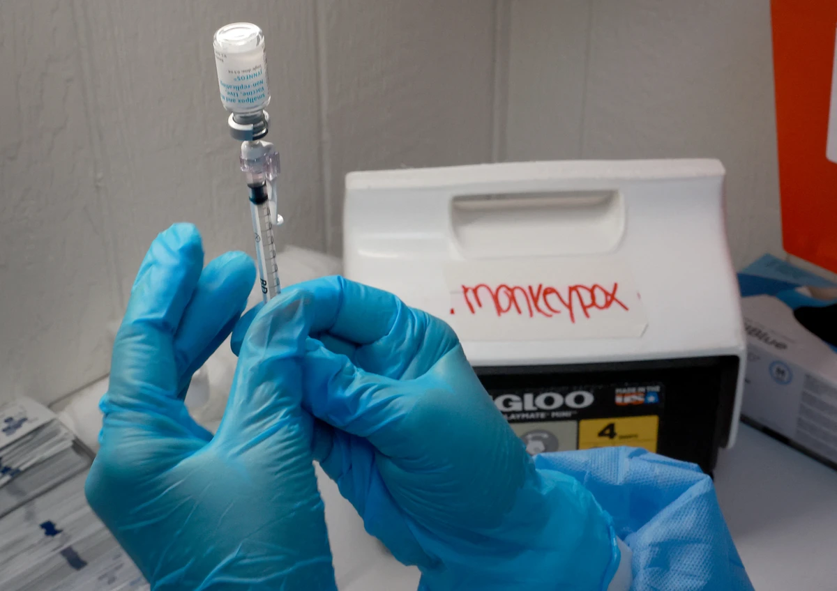 34-year-old woman is Iran’s first monkeypox case