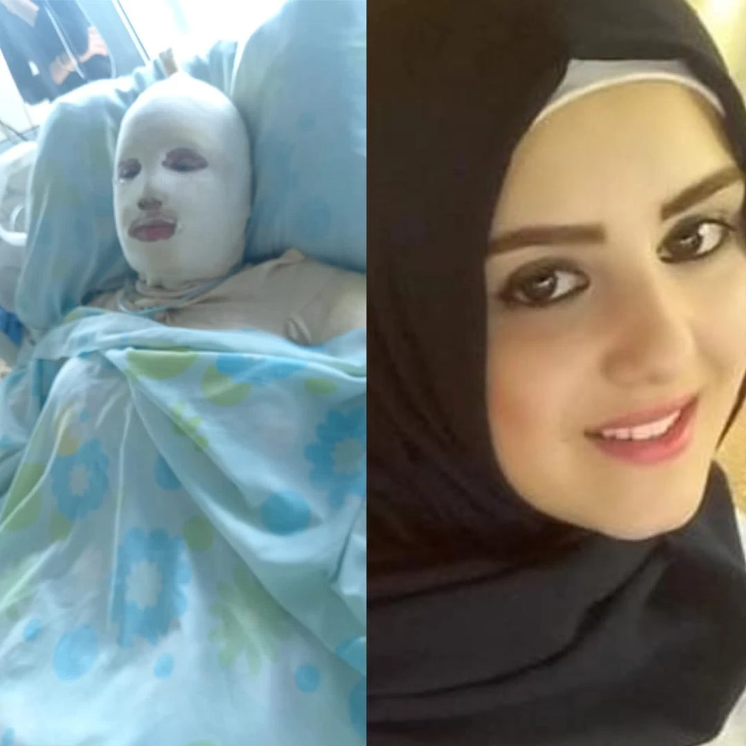 Lebanese woman set on fire by husband over unwanted pregnancy