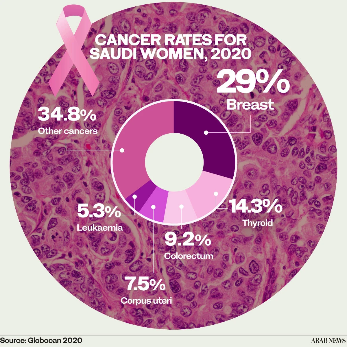 How tech is revolutionizing breast cancer diagnosis and treatment in Saudi Arabia