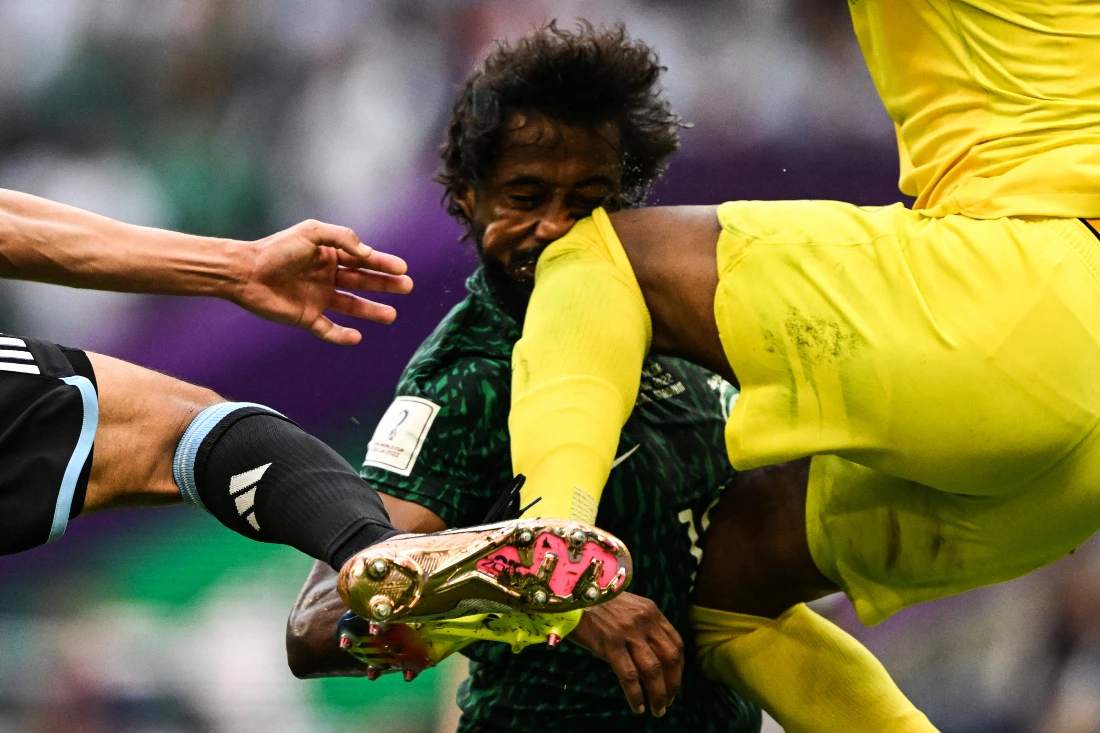 Saudi footballer Yasser Al-Shahrani collided with goalkeeper Mohammed al-Owais during the Kingdom’s historic match with Argentina at the World Cup in Qatar. (AFP)