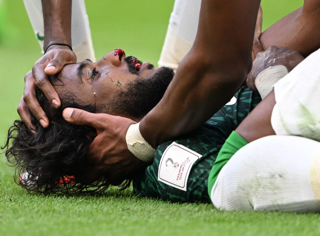 Saudi defender Yasser Al-Shahrani was carried off the pitch on a stretcher after sustaining serious injuries during the Kingdom’s historic match with Argentina. (File/AFP)