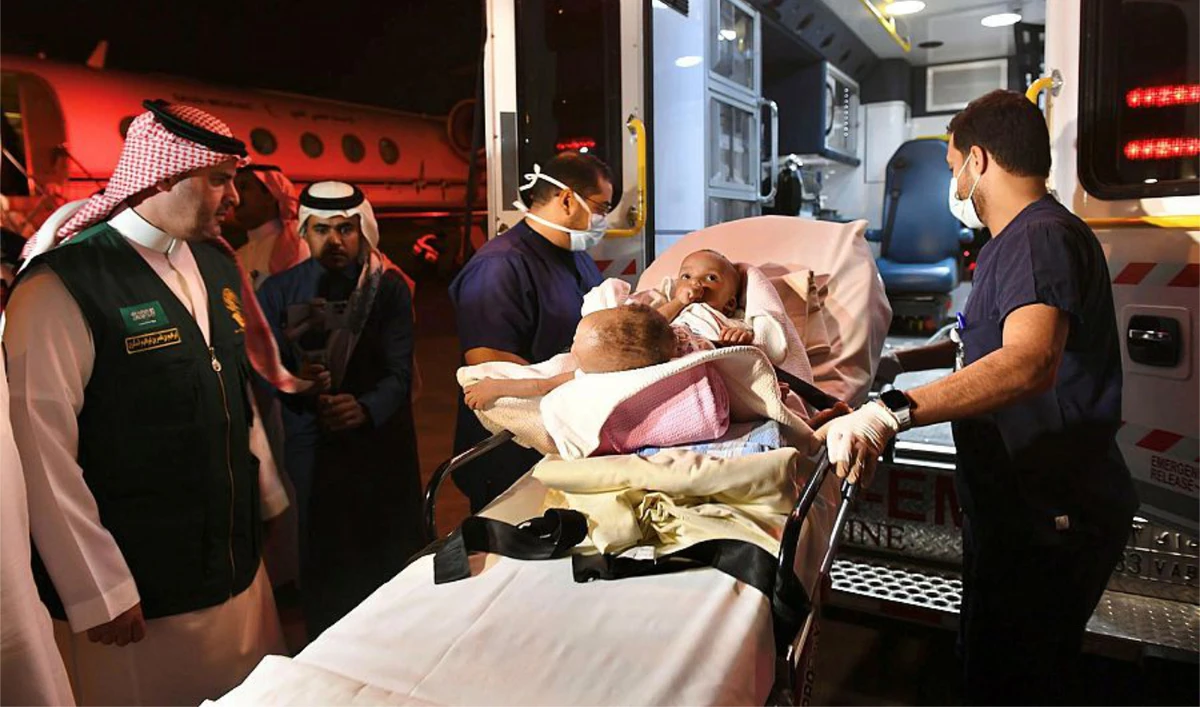 Yahaya Lawal, Nigeria’s envoy to the Kingdom, said the monarch had sent a flying ambulance to transport the twins and their parents to Riyadh, where the surgery would take place. (SPA)