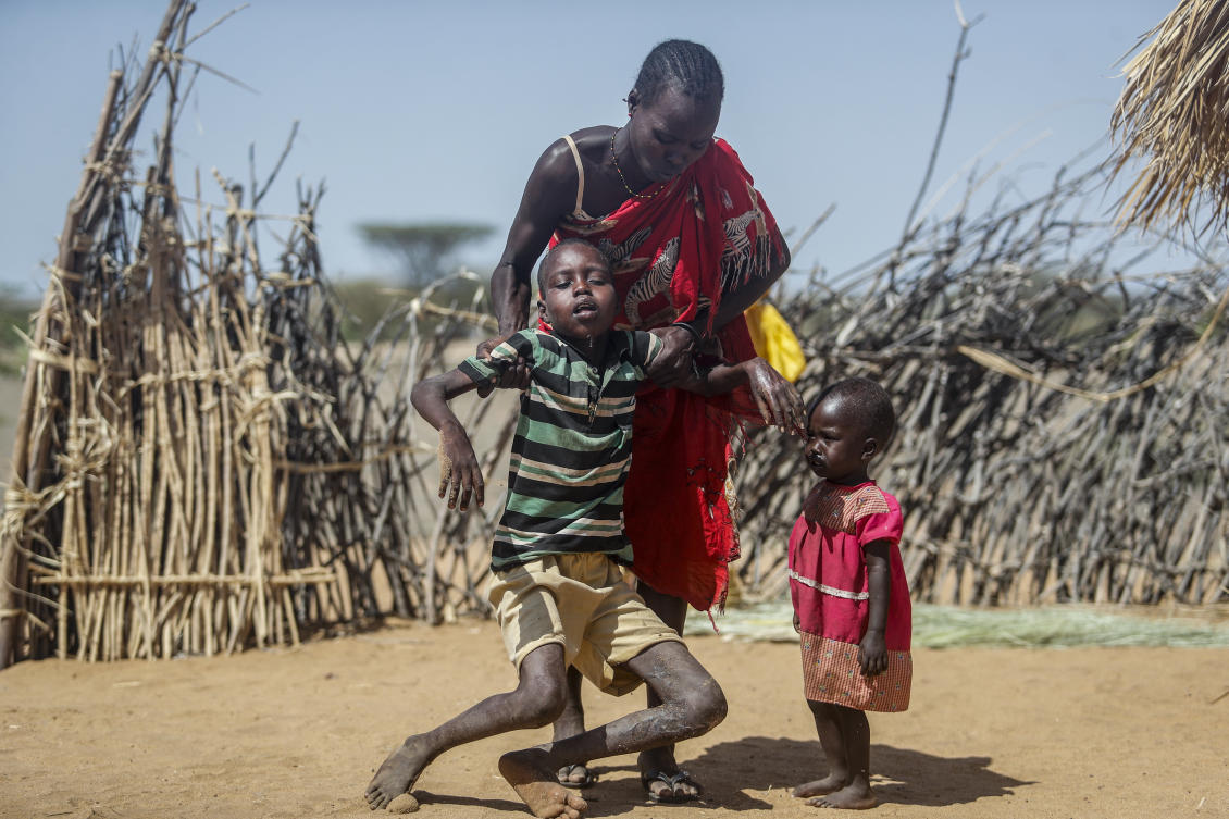 An international team of climate scientists says the ongoing drought in Eastern Africa has been made worse by human-induced climate change according to a report from World Weather Attribution. (AP/File Photo)