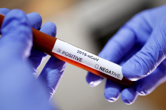 NYU Abu Dhabi develops fast test for COVID-19