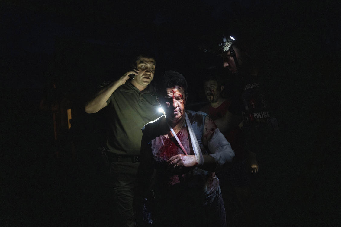 Escalating Russian rocket attacks in Ukrainian territory have injured non-combatants such as this resident from Pokrovsk on June 21, 2023. (AP)