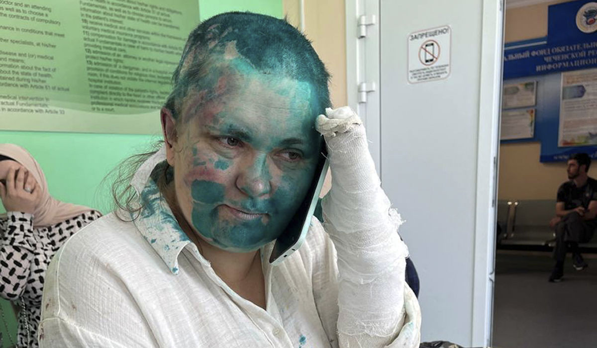 Masked assailants attack a journalist and a lawyer in Russia’s Chechnya province