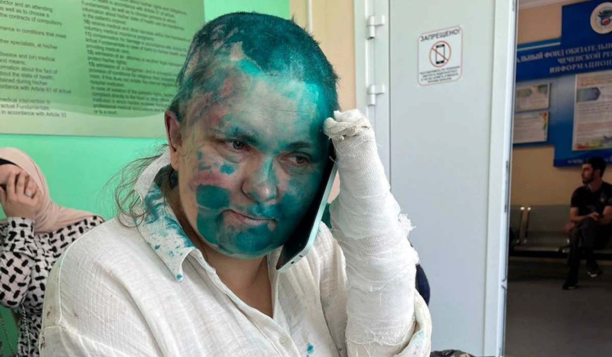 In this handout photo released by Novaya Gazeta Europe via web site Novayagazeta.eu on Tuesday, July 4, 2023, Novaya Gazeta journalist Elena Milashina sitts after giving her a medical treatment in Grozny, Russia. (AP)