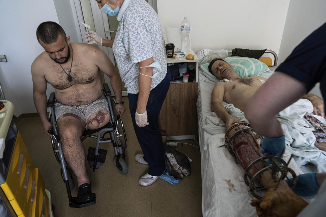 At a rehabilitation hospital in the western city of Lviv, soldiers rely as much on each other as they do upon the physicians and rehabilitation specialists they will need to adapt to their new prostheses. (AP)
