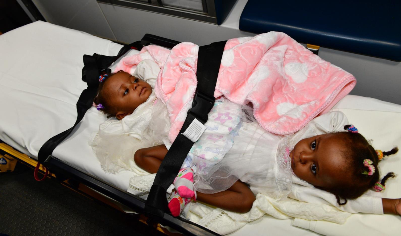 Hasna and Hasina were transported to the King Abdullah Specialist Hospital for Children to study their condition and consider the possibility of separating them. (SPA)
