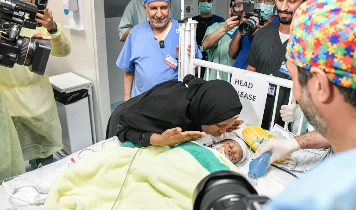 The medical and surgical team separated Hassan and Hussein, aged 2, at King Abdullah Specialist Children’s Hospital in the King Abdulaziz Medical City at the Ministry of National Guard in Riyadh. (SPA)