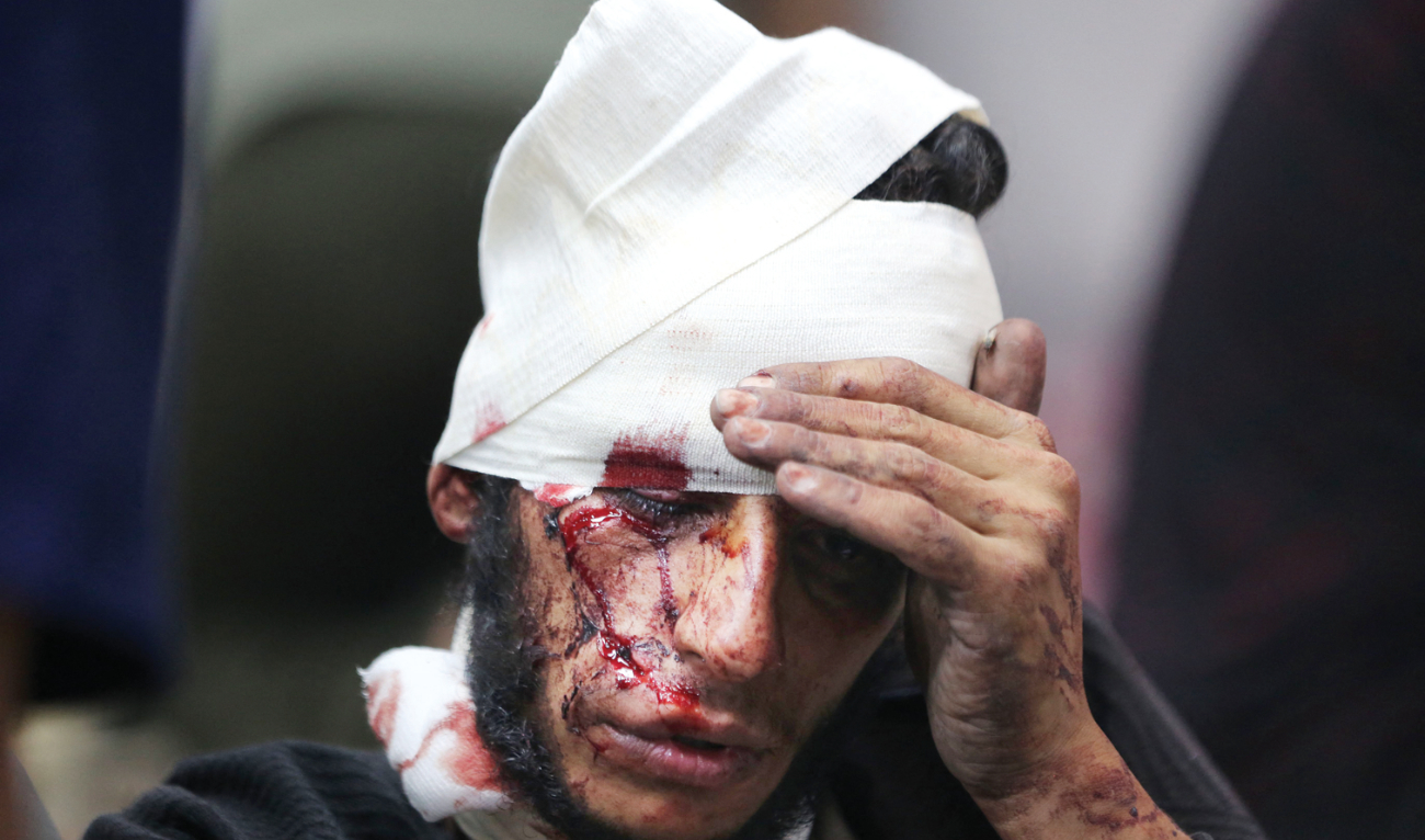 A wounded Palestinian receives treatment at Al-Shifa Hospital amid the Israeli bombardment on the Gaza Strip. (AFP)
