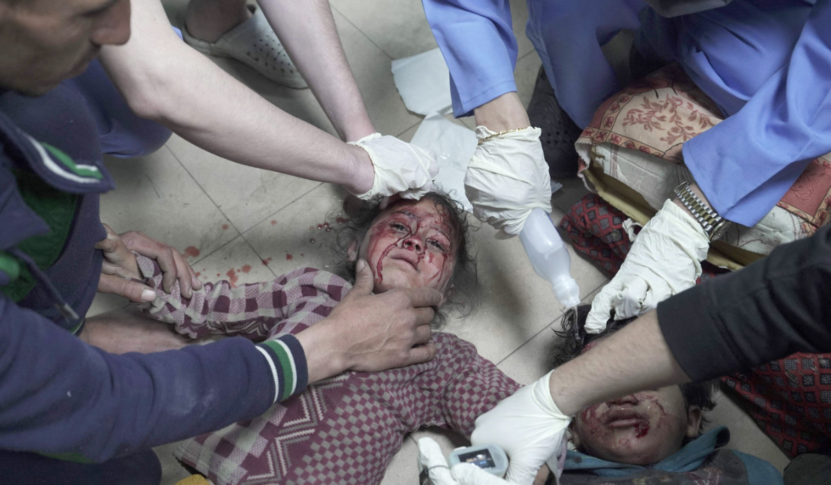 Wounded Palestinian children receive treatment at the Al-Aqsa Martyrs Hospital after Israeli bombardment in Deir Balah in the central Gaza Strip on March 9, 2024, amid ongoing battles between Israel and the Palestinian group Hamas. (AFP)