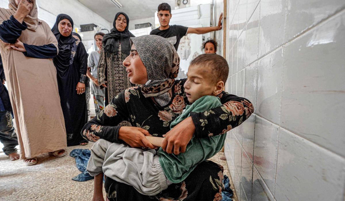 The body of Eyad Hegazi rests in the arms of his sister after he died at the Aqsa Martyrs hospital in in Gaza. (AFP)