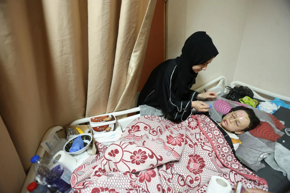 Palestinian girl with burns from Israeli shelling hopes for treatment