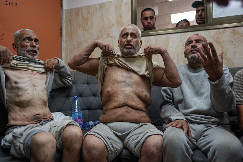 Palestinian men who had been detained by Israeli forces arrive for a check-up at the Al-Aqsa Martyrs Hospital in Deir Al-Balah of central Gaza Strip on July 1, 2024. ( AFP)
