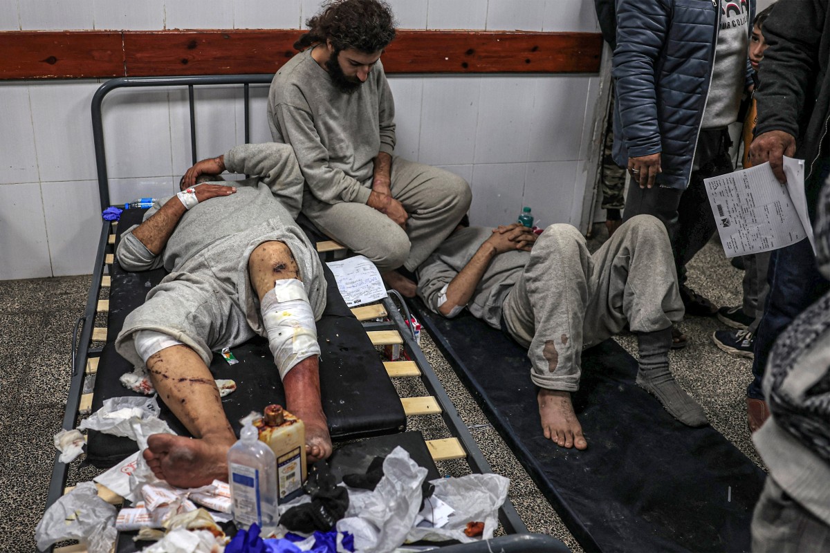 Blindfolded, beaten and sometimes bitten by dogs, Gazans released from Israeli prisons allege being tortured amid the Israel-Hamas war, which rig (AFP)