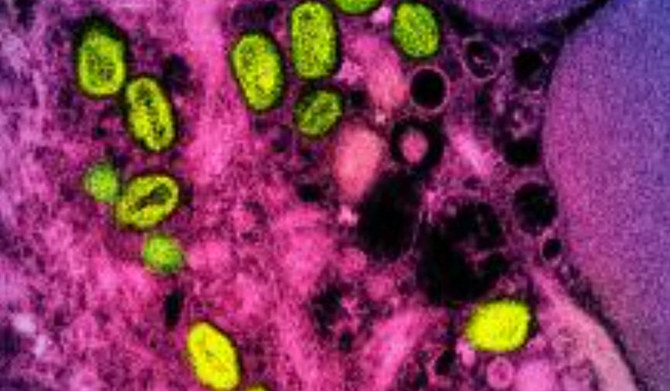 Kenya has detected its first case of mpox, the health ministry said Wednesday, as the regional East African bloc urged caution in the face of an outbreak. (AFP/File)