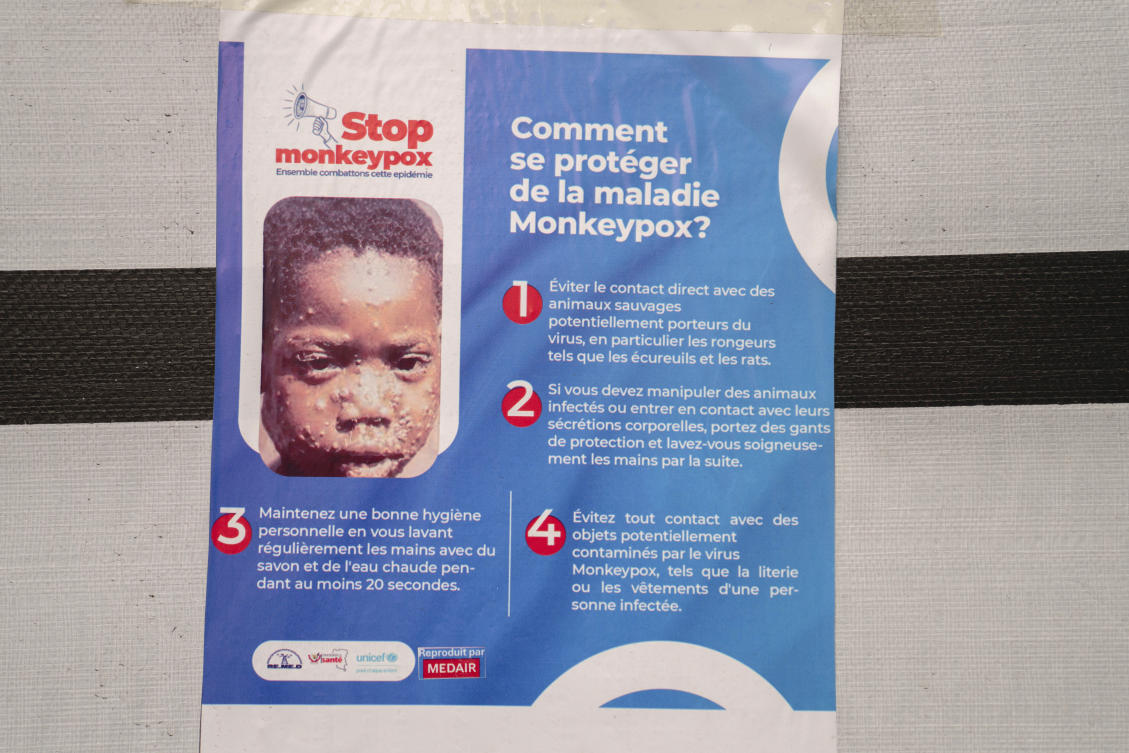 A poster bringing attention to the mpox outbreak hangs at the Goma General Hospital, Democratic Republic of the Congo, on Jul. 16, 2024. (AP)
