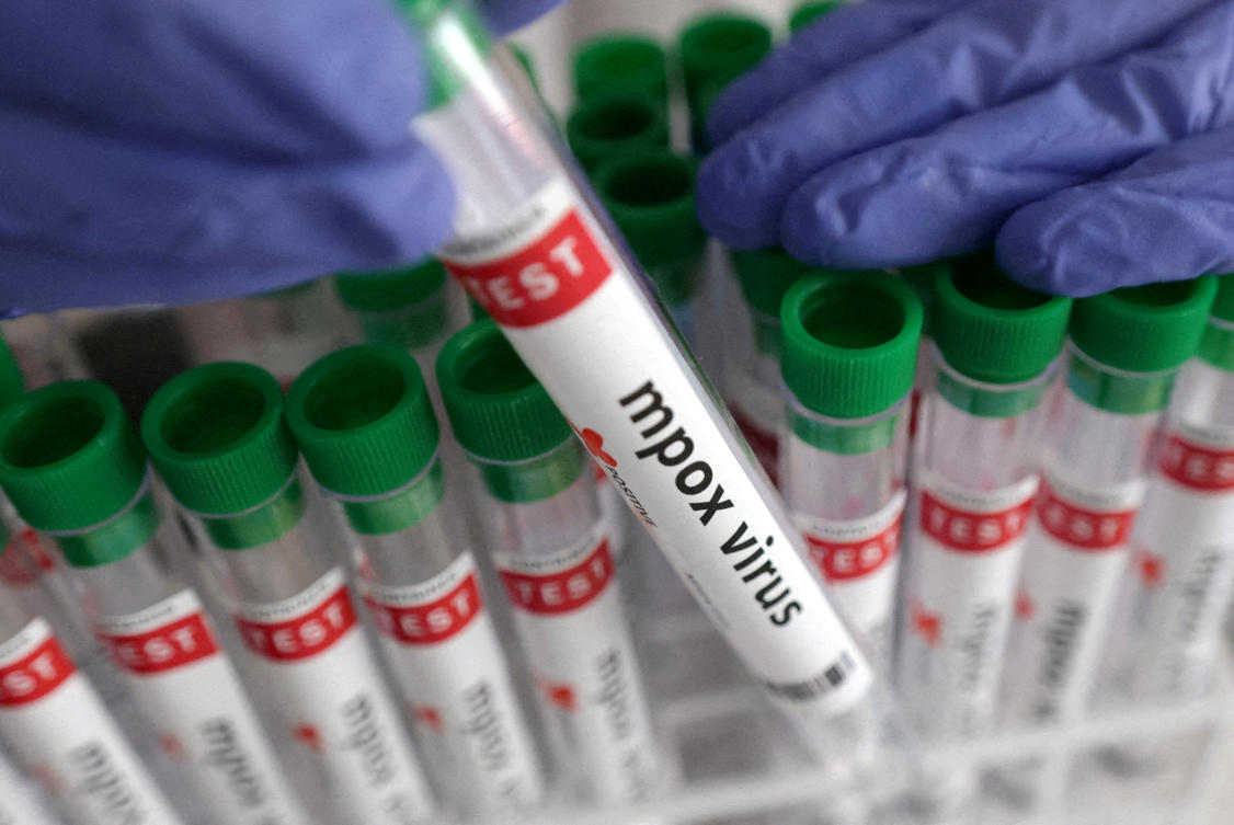 FILE PHOTO: A test tube labelled “Mpox virus positive” is held in this illustration taken August 20, 2024. (REUTERS)