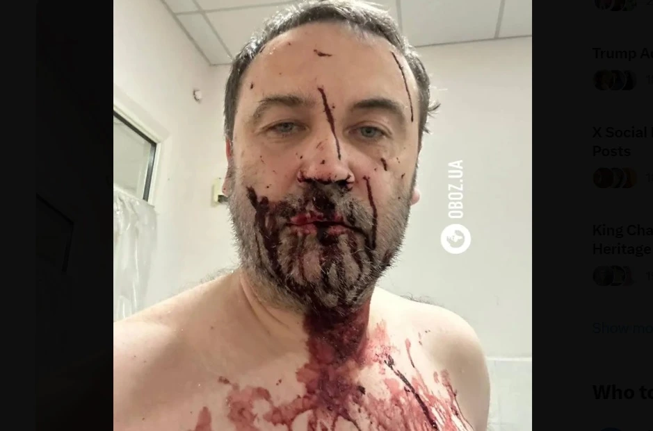 Ukraine says it had repelled a Russian drone attack outside Kyiv overnight, but that debris injured two people, including Ilya Ponomaryov, a onetime Russian lawmaker turned Kremlin critic. (X/@novayagazeta_en)