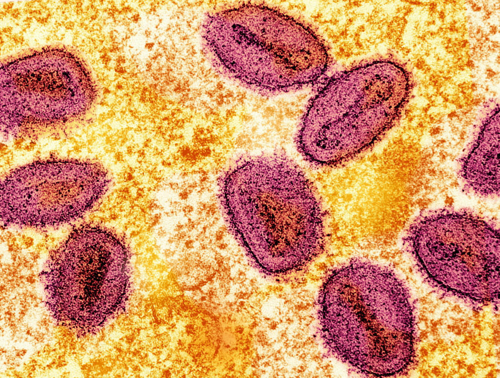 One mpox case found in Uganda prison, official says