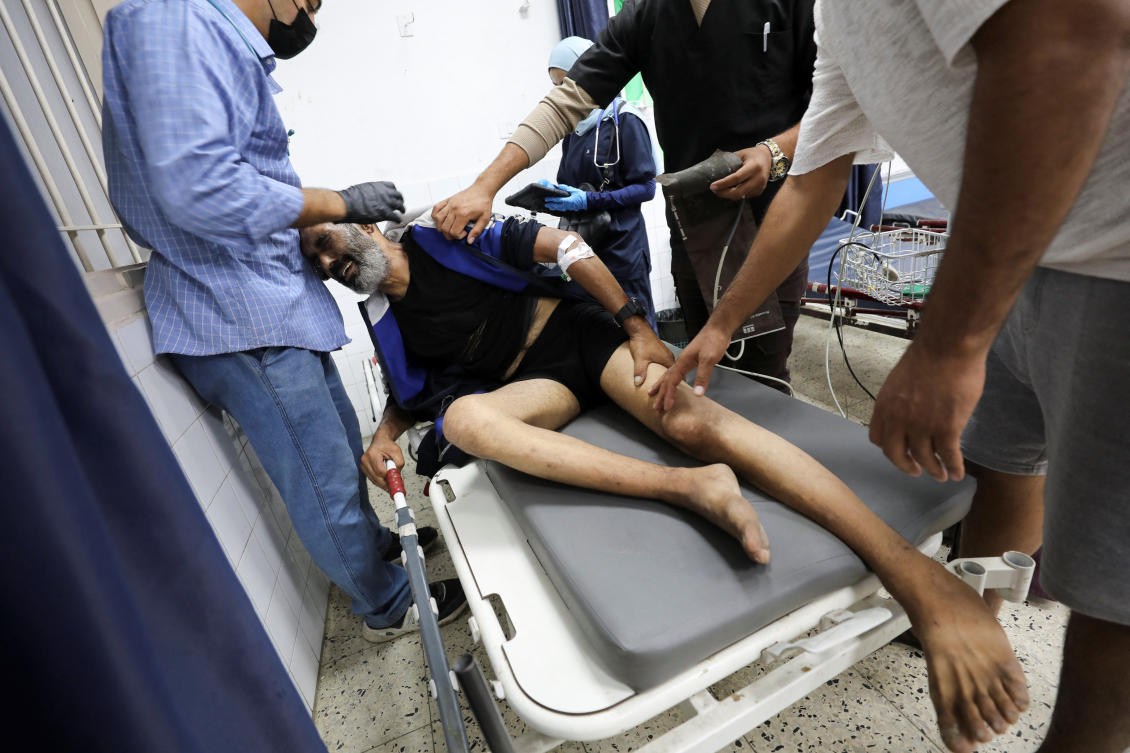 An injured Palestinian man is treated in hospital, in the aftermath of an Israeli strike, amid the Israel-Hamas conflict, in Gaza City October 18, 2024. (REUTERS)