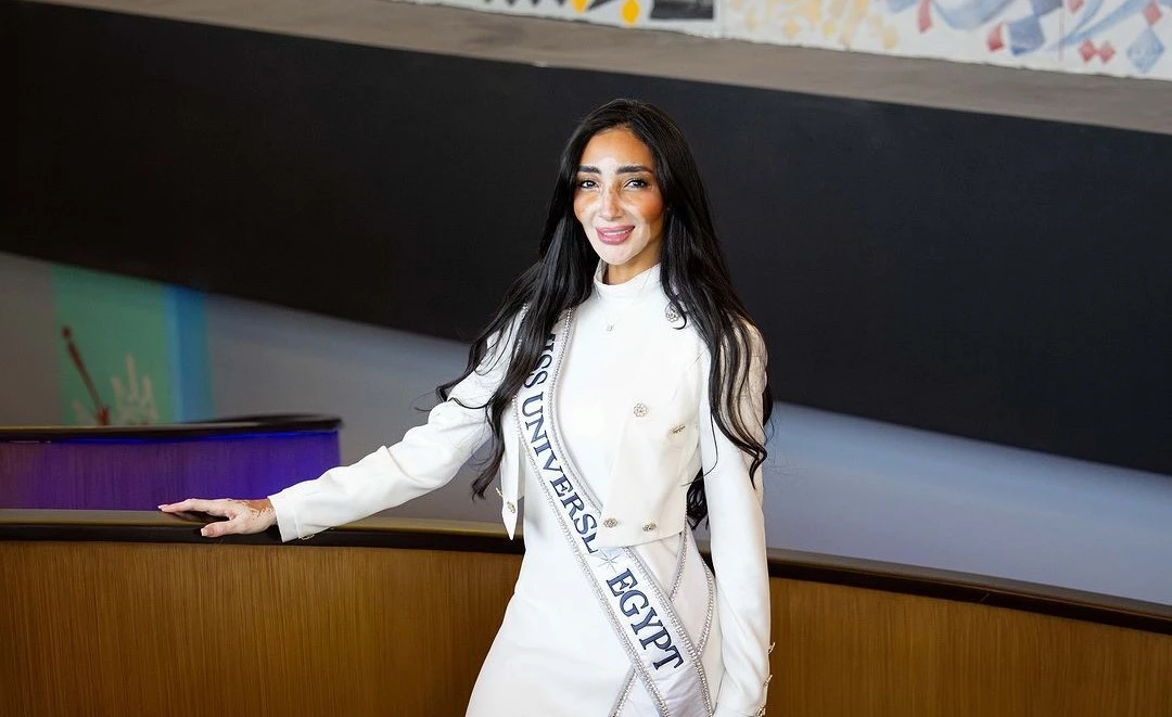 Egyptian model Logina Salah was recently crowned Miss Universe Egypt 2024, a victory that she believes signifies progress toward greater inclusivity in the world. (Instagram)