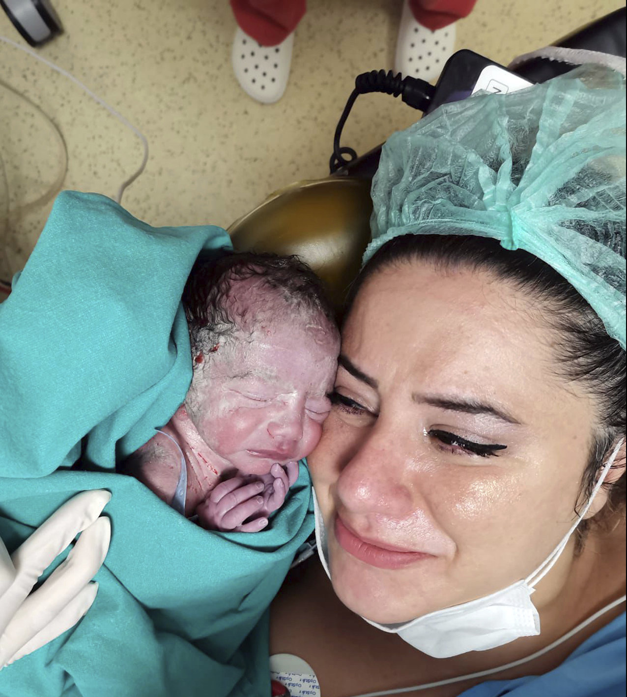 In this photo provided by the Gokdeniz family, Burcu Gokdeniz holds her newborn baby Umut Ali Gokdeniz for the first time moments after the preterm birth in Istanbul, Turkey, on Aug. 25, 2020. (Gokdeniz family via AP)