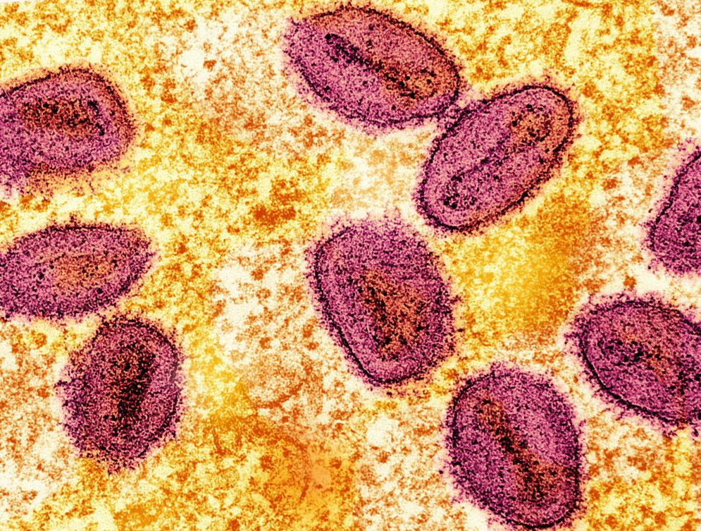 Two UK mpox cases first local transmission in Europe: WHO