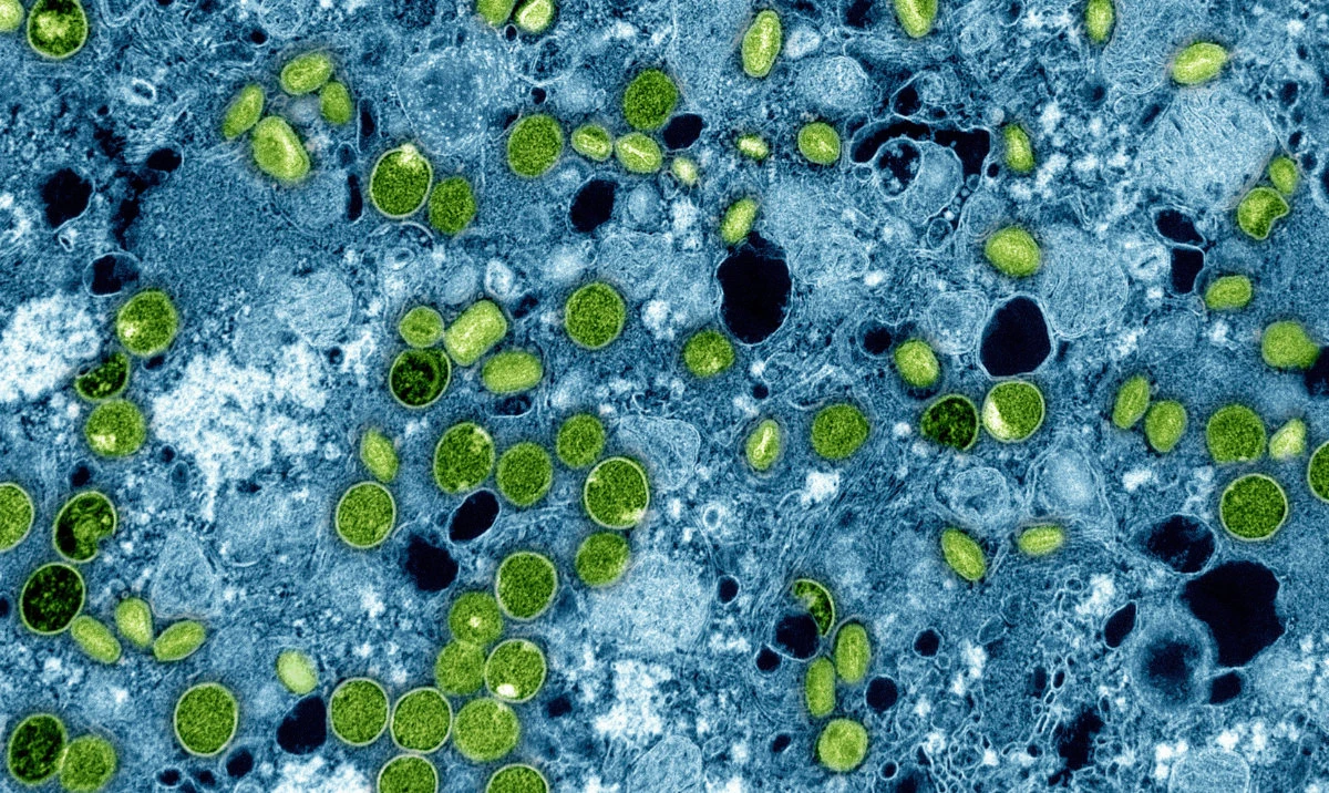 This colorized electron microscope image provided by the National Institute of Allergy and Infectious Diseases in 2024 shows Mpox virus particles, green, found within infected cultured cells, blue. The virus particles are in various stages of maturity, which accounts for differences in shape. (AP/File)