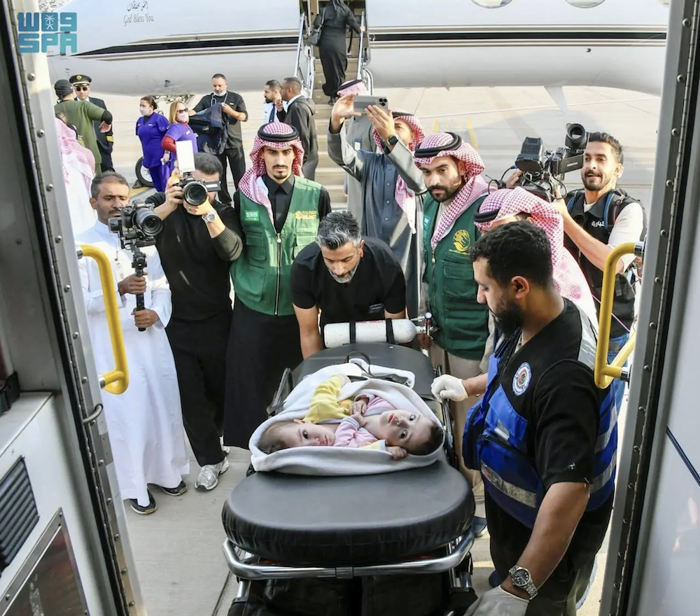 Syrian conjoined twins arrive in Saudi Arabia for medical assessment