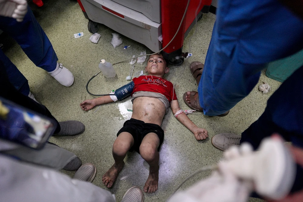 A wounded child lies on the floor and receives medical treatment at the Nasser hospital following the Israeli military targeting of a southeastern district of Khan Younis on July 25, 2024. (AFP file photo)