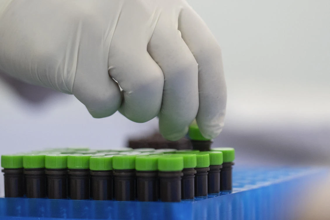 A view of mpox test kits is displayed in Moldiag, a biotechnology startup, in Tamesna, Morocco, Thursday, Nov. 28, 2024. (AP)