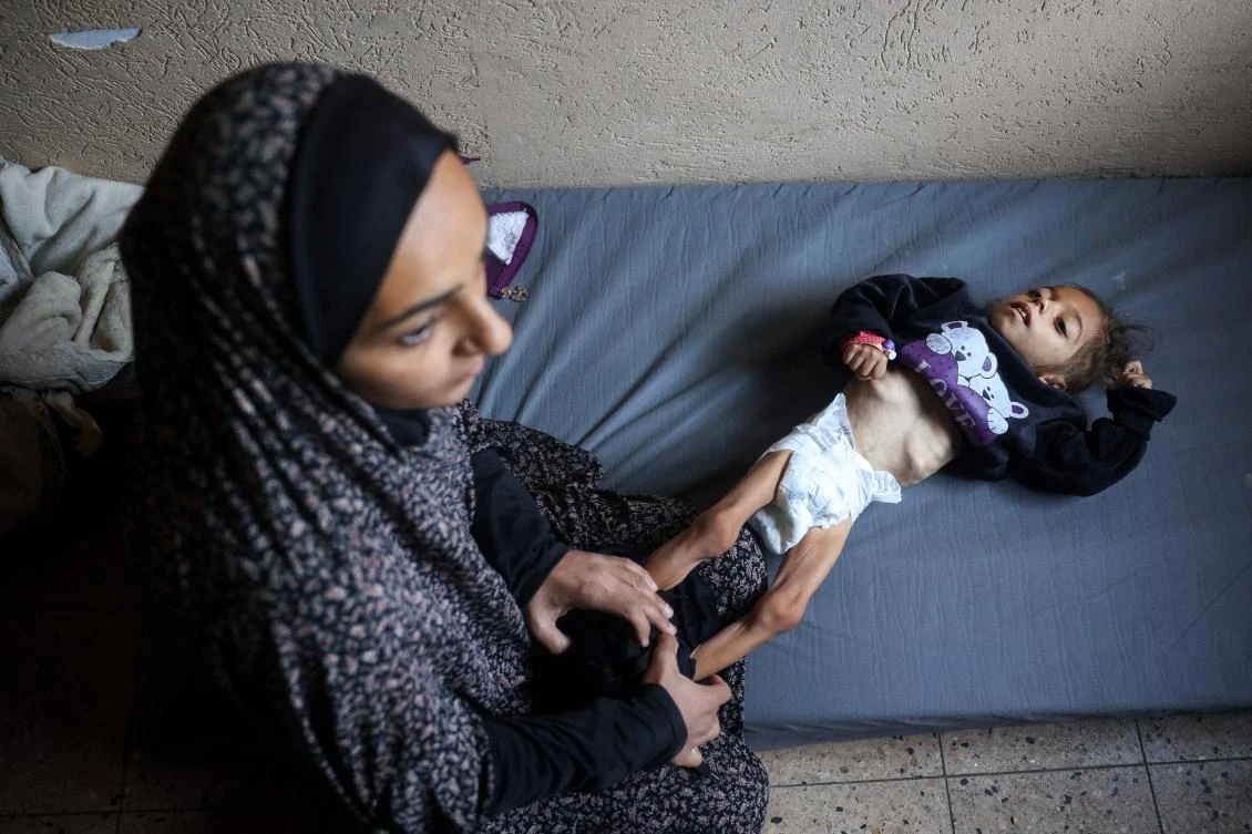A Palestinian mother changes the clothes of her five-year-old daughter suffering from malnutrition, at a shelter they live in after being displaced by the war, in the central Gaza Strip, on December 24, 2024. (AFP)