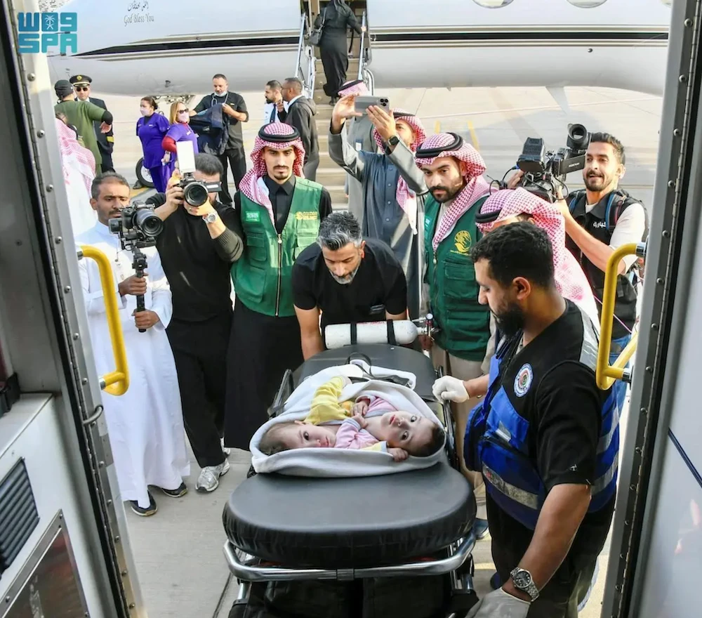 Syrian conjoined twins arrive in Saudi Arabia for medical assessment