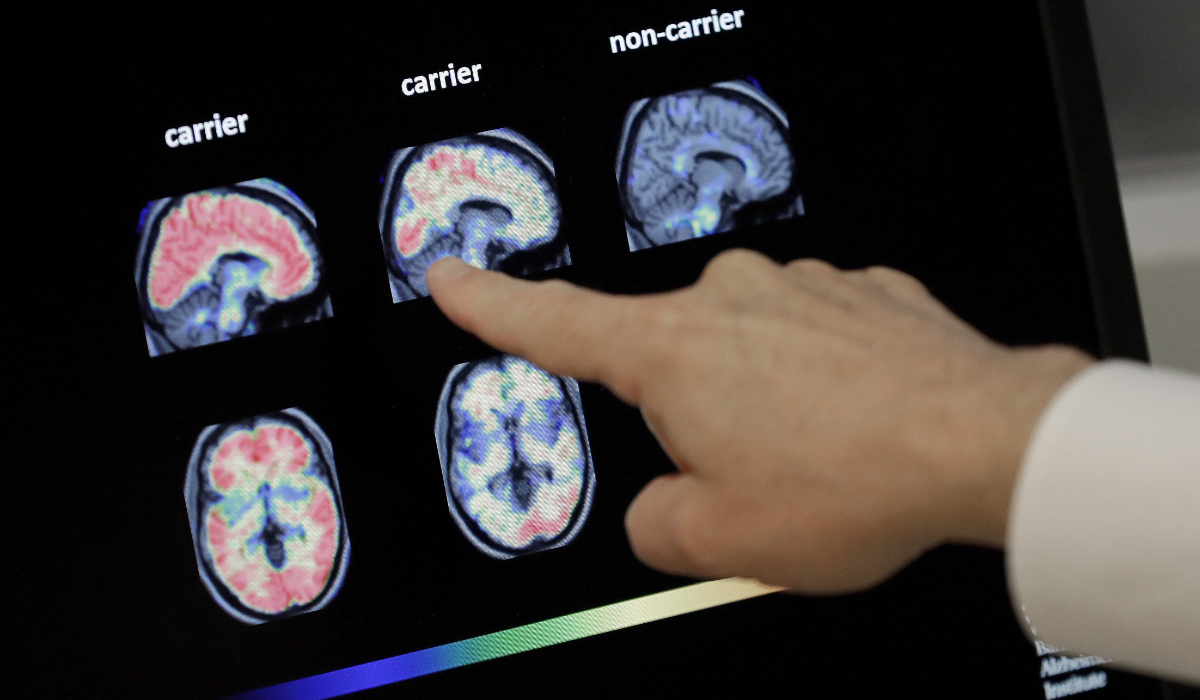 Up to 4 in 10 people could develop dementia after 55. What you can do to lower your risk
