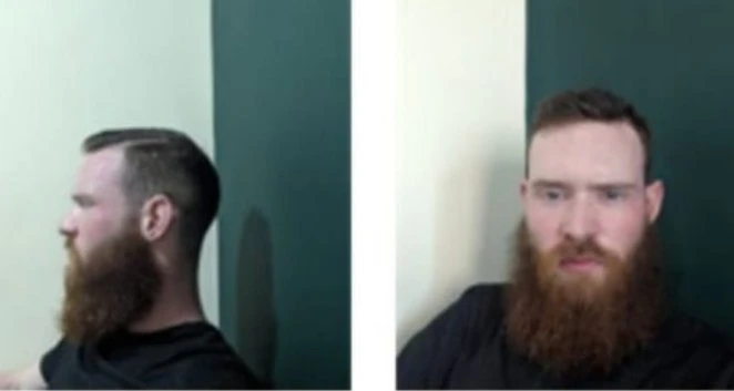 Former US Army soldier Jack Danaher Molloy reportedly posted these pictures of himself on social media and were subsequently shared on X by multiple users. (X photo)