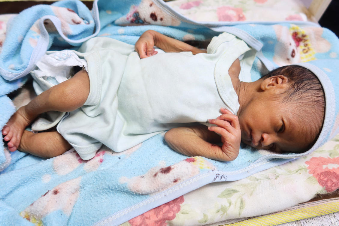 A baby suffering from malnutrition lies on a bed in Alban Jadeed hospital, as young children struggling with malnutrition fill wards in the Sharg Elnil area, in Khartoum, Mar. 15, 2025. (Reuters)