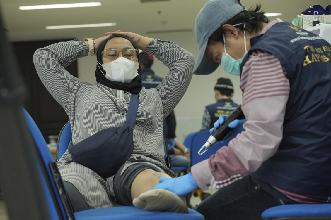 A Muslim takes the service of a free tattoo removal service offered by an Islamic charity organization during Ramadan to give practicing Muslims an opportunity to ‘repent’ in Jakarta, Indonesia on March 19, 2025. (AP)