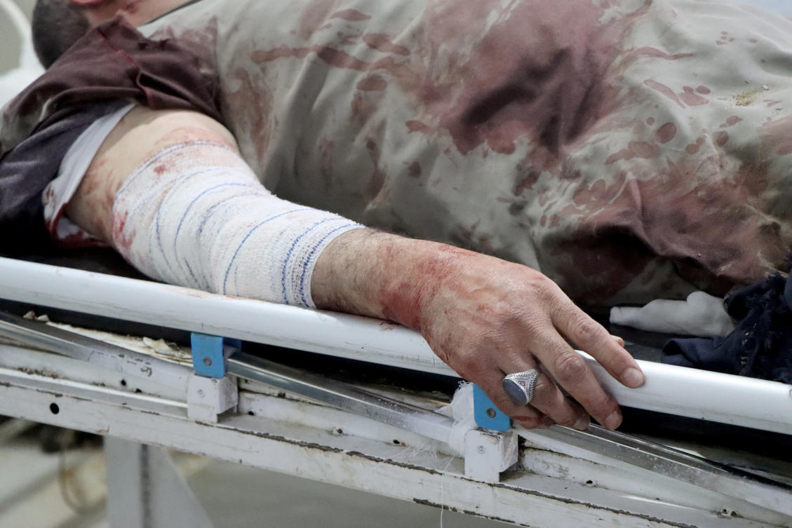 A man injured by a US air strike lies on a stretcher at a hospital in Saada, Yemen March 28, 2025. (REUTERS)