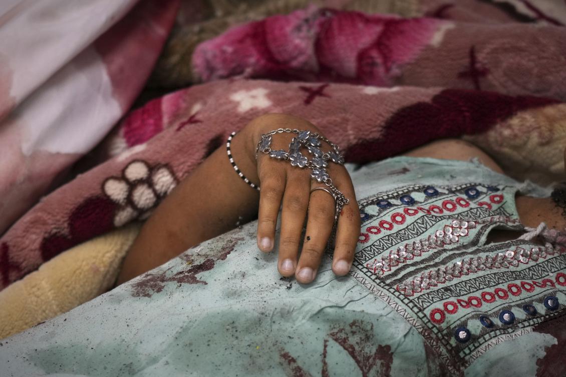 A bracelet is wrapped around the hand of 10-year-old Dana Abu Sultan, who, along with her sister, brother, parents, uncle, and aunt, was killed when an Israeli army strike hit their tent. (AP)