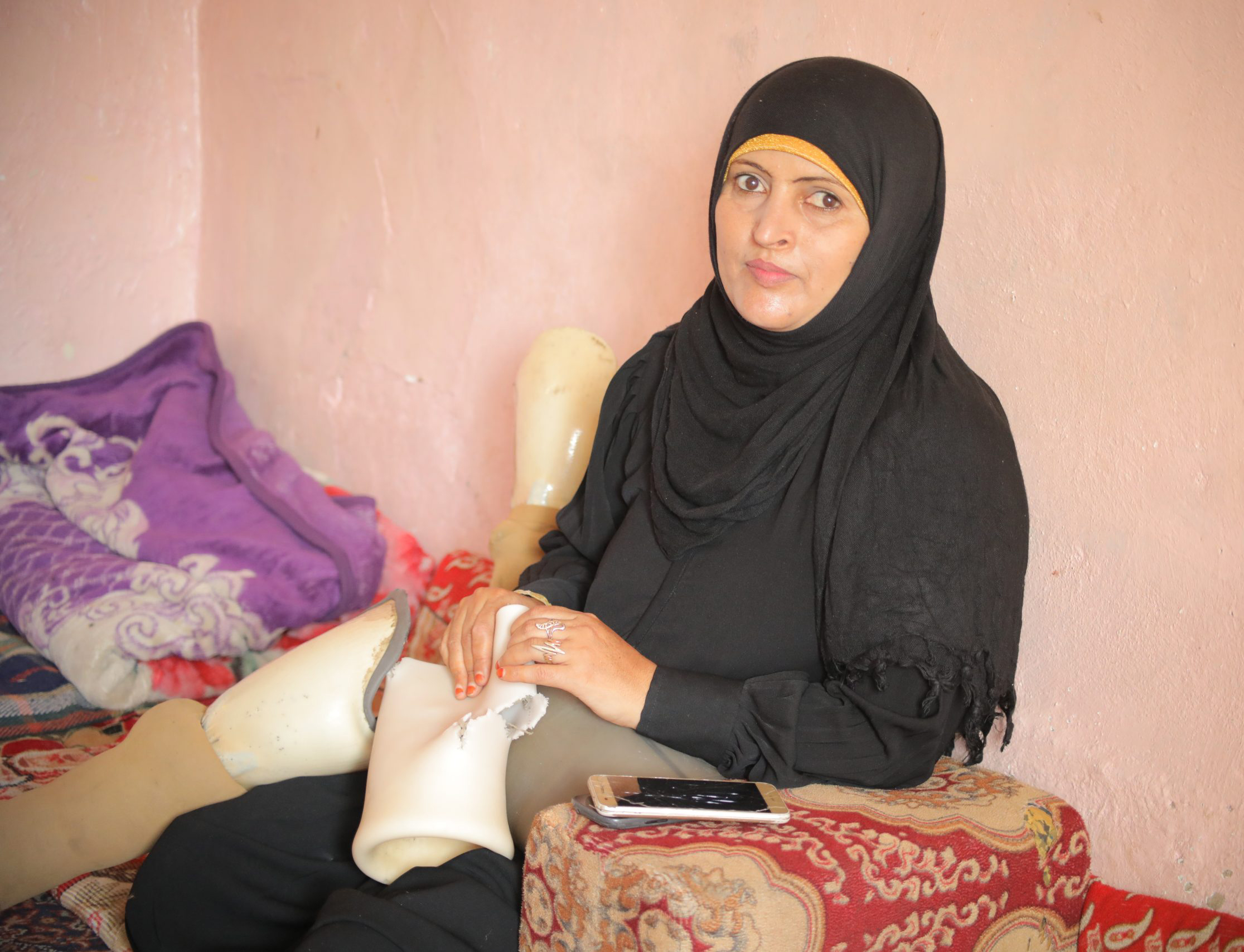 Dalila Abdo Ahmed was severely injured by landmines near her home on her wedding morning in Taiz governorate, Yemen. (Supplied/ Project Masam)