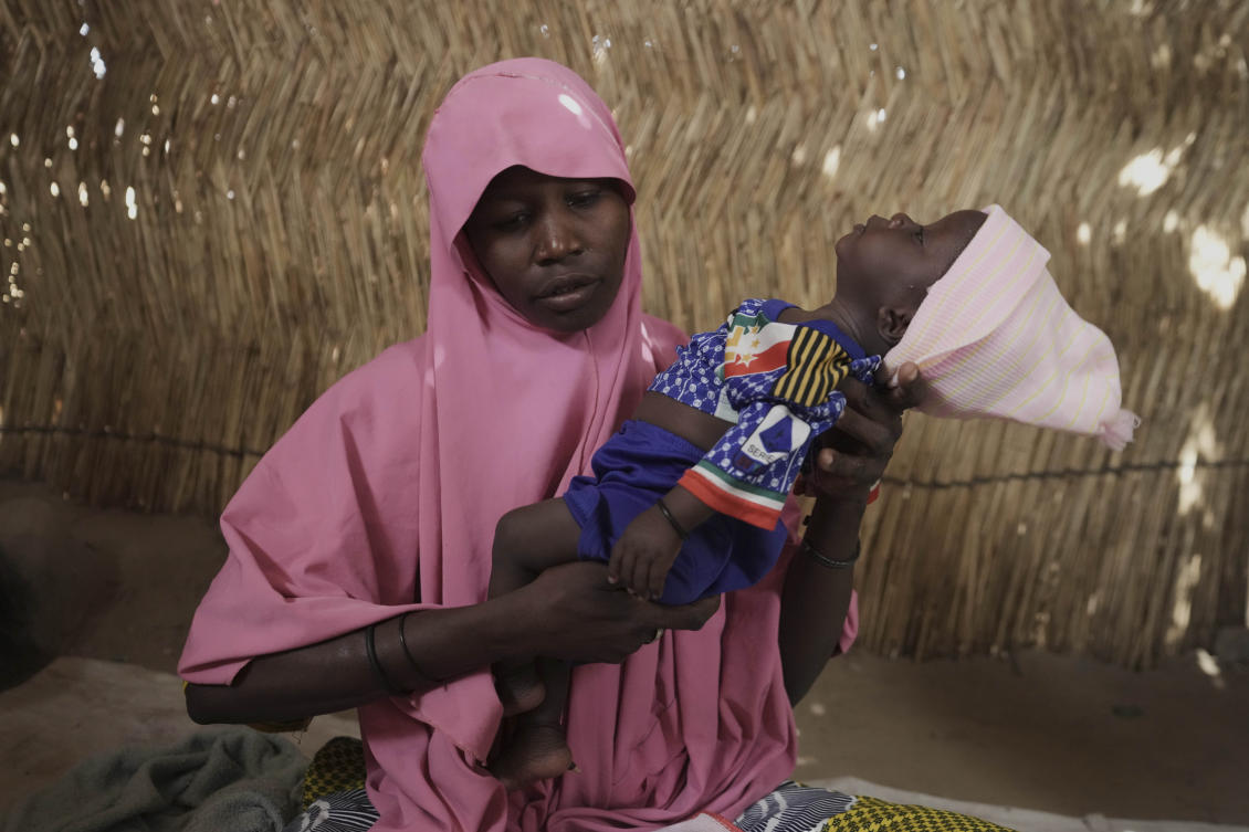 Yagana Bulama, a 40 years old woman plays with her surviving infant under the dappled light of a thatched shelter in Dikwa, northeastern, Nigeria, Apr. 29, 2025. (AP)