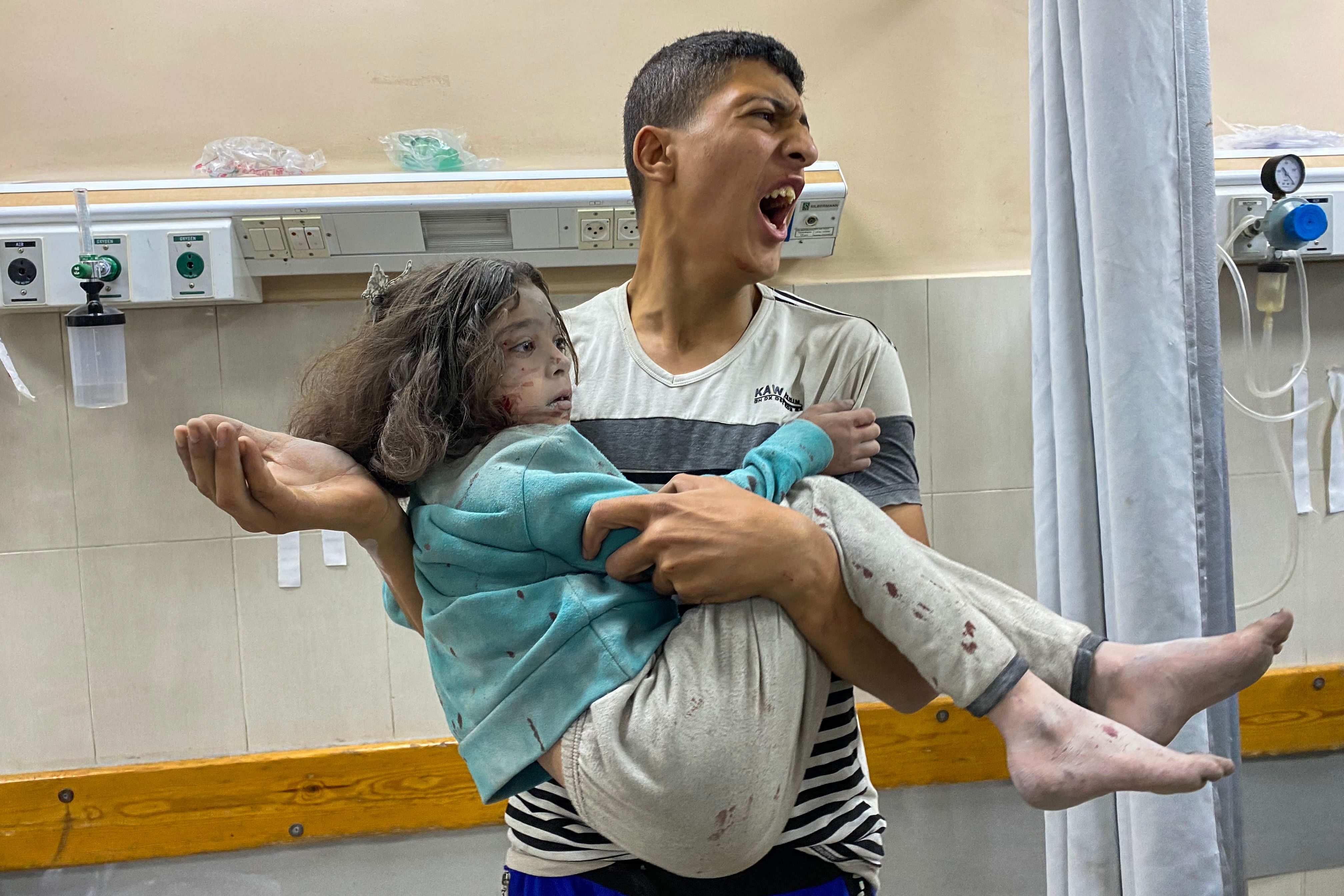A Palestinian man rushes a girl who was injured in Israeli strikes on displacement tents in Khan Yunis, at the Nasser hospital in the southern Gaza Strip on Tuesday. (AFP)