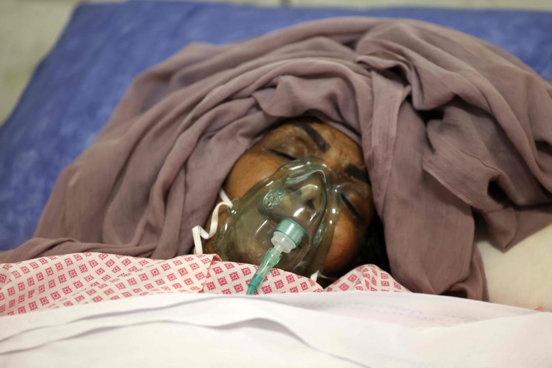 A woman injured in an Israeli strike, lies in a bed at the Rasoul Akram hospital in Tehran on Jun. 21, 2025, as Israel’s war with Iran has entered its second week. (AFP)