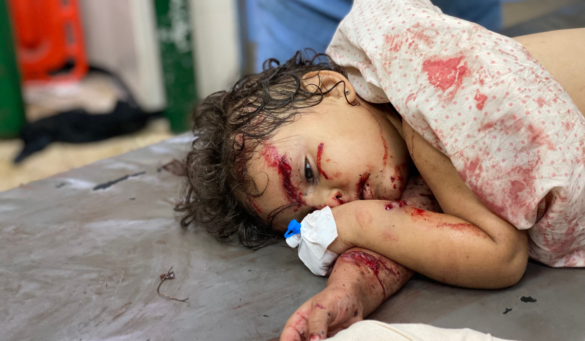 A girl receives treatment for her wounds, sustained in an Israeli strike on a camp housing displaced Palestinians, at Khan Yunis' Nasser hospital in the southern Gaza Strip on July 2, 2025. (AFP)