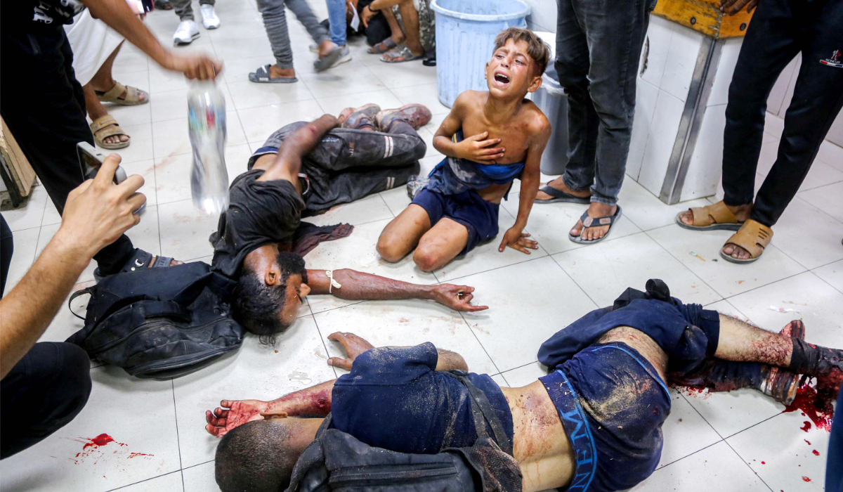 An injured boy reacts as he sits on the ground by other men who were all wounded while previously queueing for aid, at Nasser Medical Complex in Khan Yunis in the southern Gaza Strip on July 20, 2025. (AFP)