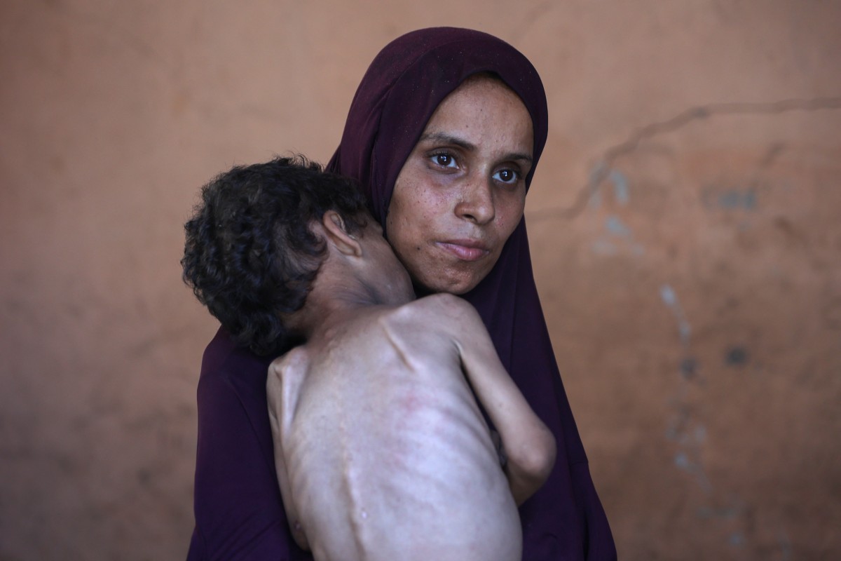 Naeema, a 30-year-old Palestinian mother, carries her malnourished 2-year-old son, Yazan, as they stand in their damaged home in the Al-Shati refugee camp, west of Gaza City, July 23, 2025. (AFP)